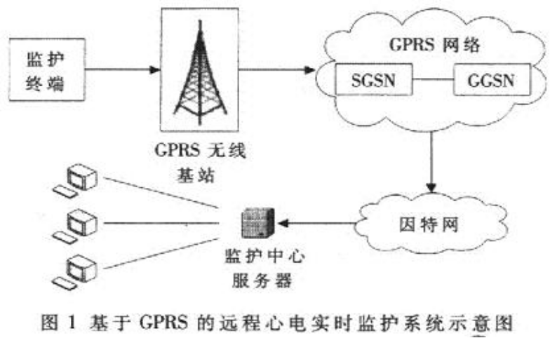 远程心电监护