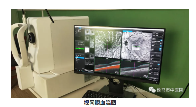 微真·血流扫频OCTA（眼科）(图1)